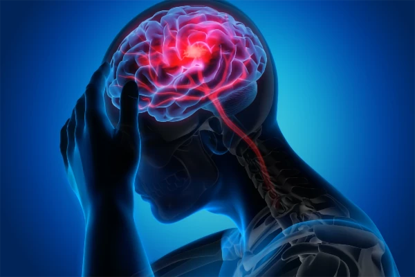 Image for article titled Stroke Awareness Month